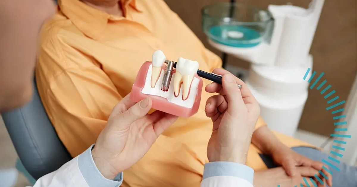 What Should I Expect After Dental Implant Treatment