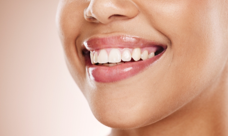 Cosmetic Dentistry