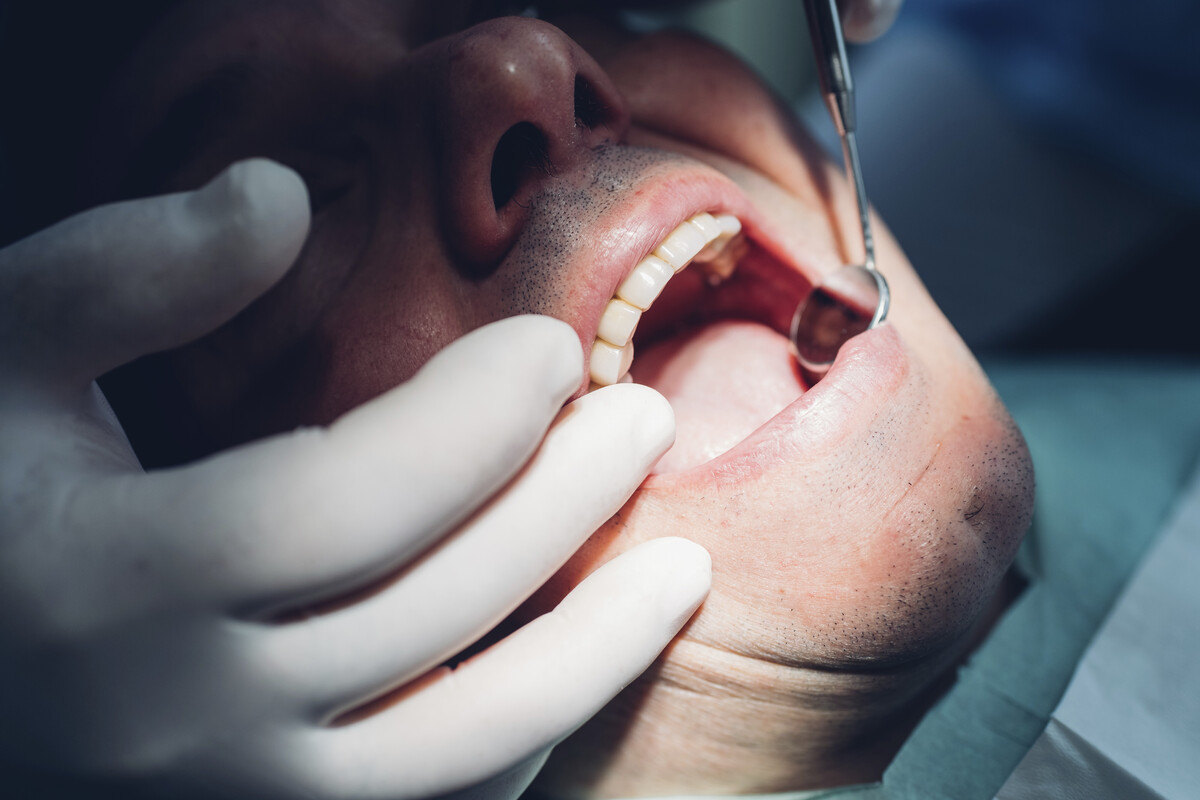 Dentist placing same-day crown during single visit