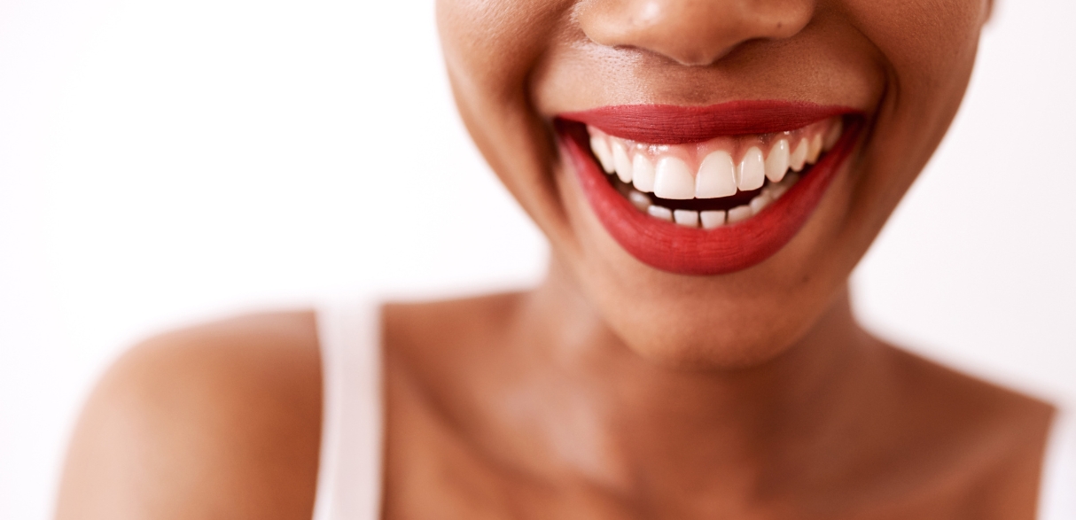 why professional teeth whitening is better